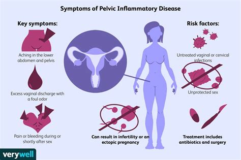 Pelvic Inflammatory Diseases (PID) is an infection of a woman's reproductive organs. . Types of pelvic infections